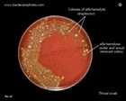 throat swab